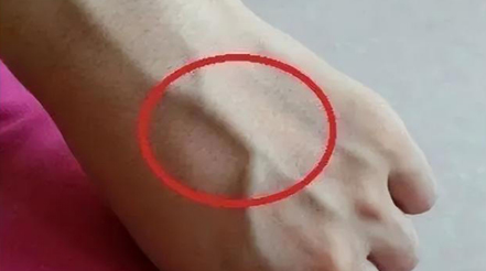 有人手臂上“青筋暴起”，有人卻看不到“青筋”，這是咋回事？