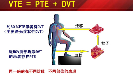 什么是臨床上一致公認(rèn)的VTE防治基礎(chǔ)？