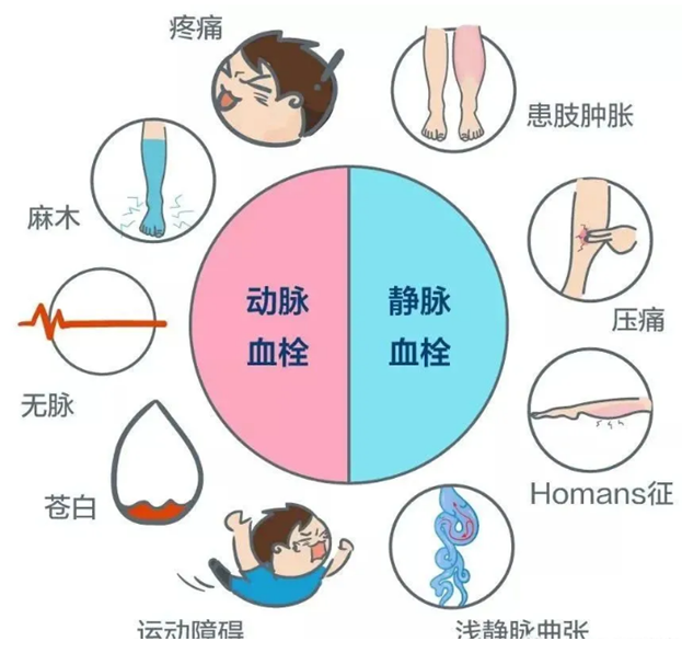 2022世界血栓日：就醫(yī)有新路，血栓找介入