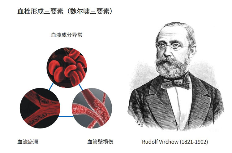 世界血栓日 | 拴不住，動起來