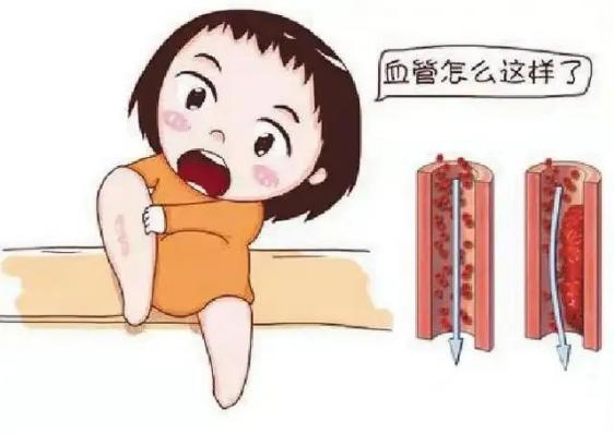 腫瘤不容忽視的第二號(hào)殺手—VTE，該如何防治？
