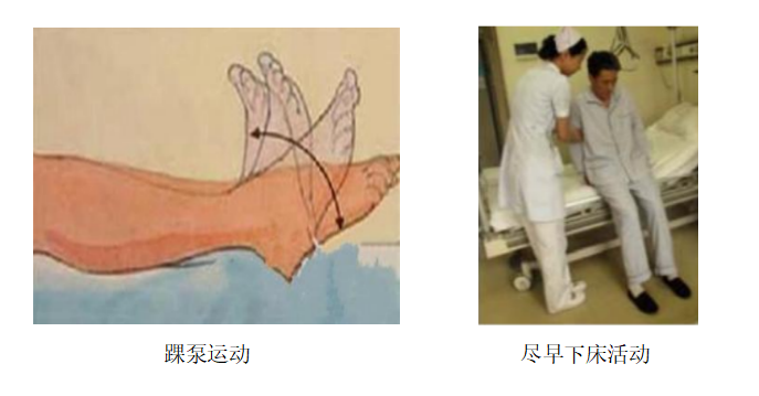 圍術(shù)期患者VTE的預(yù)防，只知道抗凝可不行