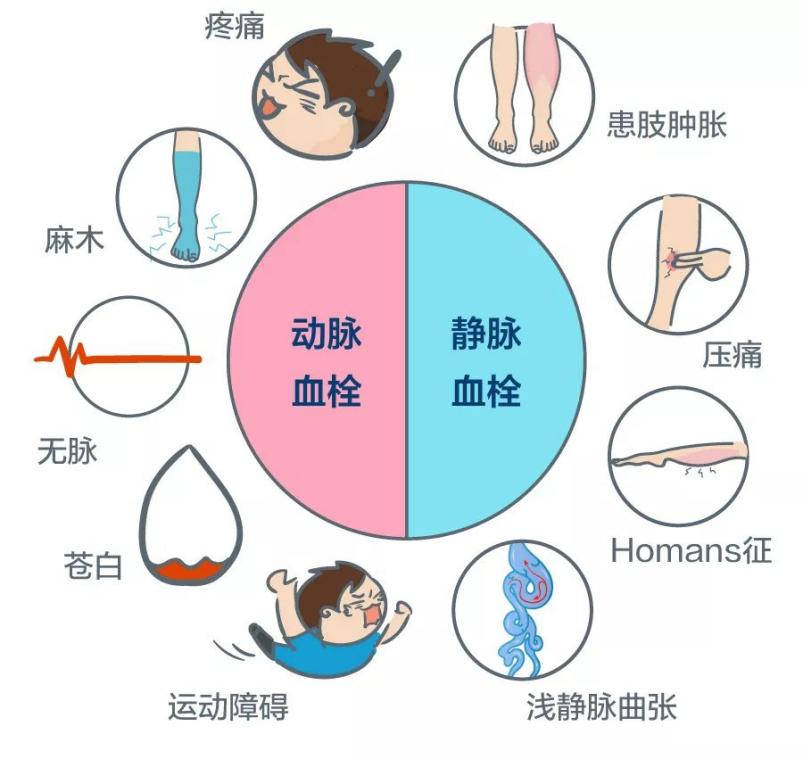 深靜脈血栓能致命，防治“大法”要了解！