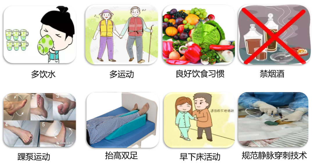 VTE的危害您了解嗎？
